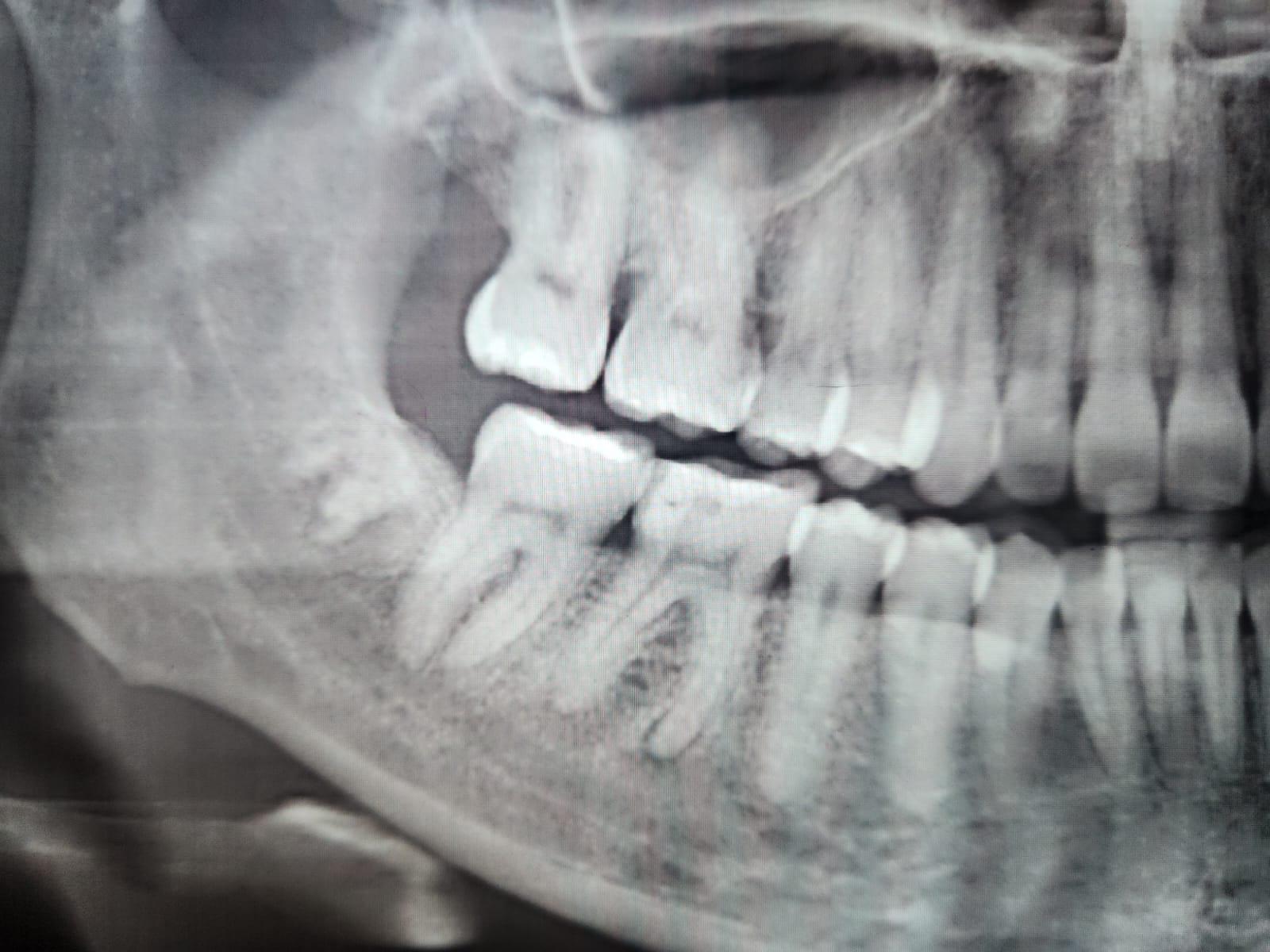 Where There Is No Dentist